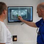 Dank der hochaufgelösten Röntgenbilder kann der Patienten besser informiert und beraten werden Digitales Röntgen OPG